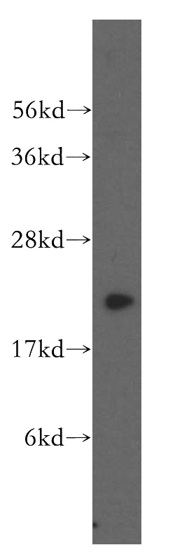 K-562 cells were subjected to SDS PAGE followed by western blot with Catalog No:109917(DHFR antibody) at dilution of 1:500