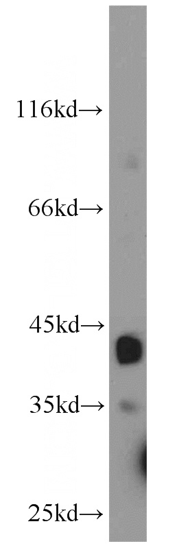 mouse skeletal muscle tissue were subjected to SDS PAGE followed by western blot with Catalog No:116322(TRIM63 antibody) at dilution of 1:300