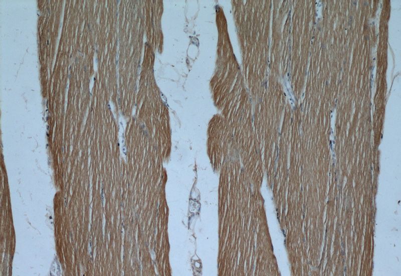 Immunohistochemical of paraffin-embedded human skeletal muscle using Catalog No:111307(HK2 antibody) at dilution of 1:50 (under 10x lens)
