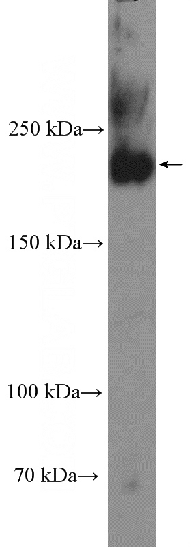 NCCIT cell were subjected to SDS PAGE followed by western blot with Catalog No:109304(CKAP5 Antibody) at dilution of 1:1000