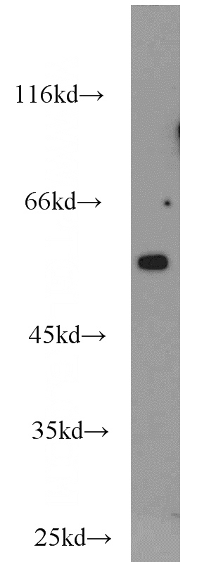 mouse brain tissue were subjected to SDS PAGE followed by western blot with Catalog No:109082(CCT3 antibody) at dilution of 1:1000