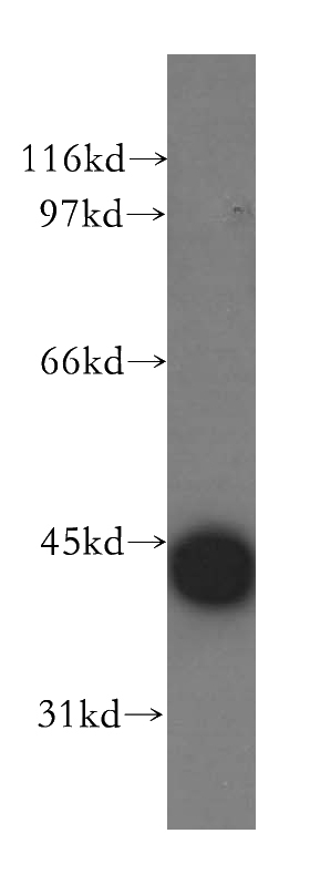 mouse thymus tissue were subjected to SDS PAGE followed by western blot with Catalog No:108912(CAMK1D antibody) at dilution of 1:500