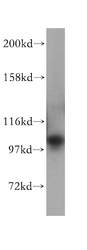 HeLa cells were subjected to SDS PAGE followed by western blot with Catalog No:113468(ocRL antibody) at dilution of 1:300