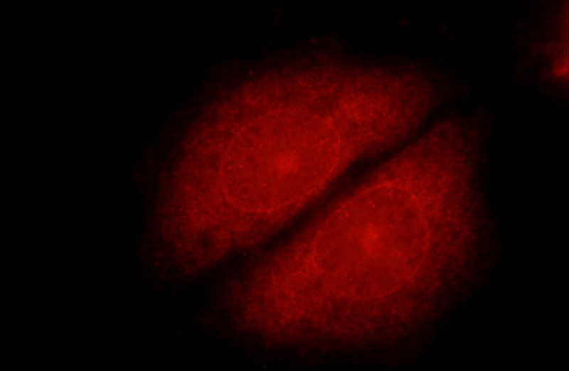 Immunofluorescent analysis of HepG2 cells using Catalog No:116511(UBE2I-Specific Antibody) at dilution of 1:25 and Rhodamine-Goat anti-Rabbit IgG