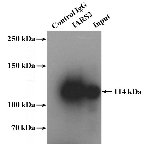 IP Result of anti-IARS2 (IP:Catalog No:111582, 4ug; Detection:Catalog No:111582 1:800) with HeLa cells lysate 4000ug.