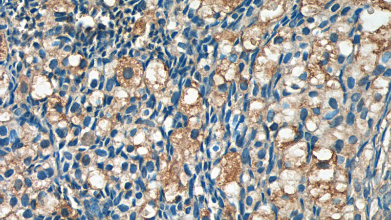 Immunohistochemistry of paraffin-embedded human ovary tissue slide using Catalog No:108264(ARHGAP21 Antibody) at dilution of 1:50 (under 40x lens)