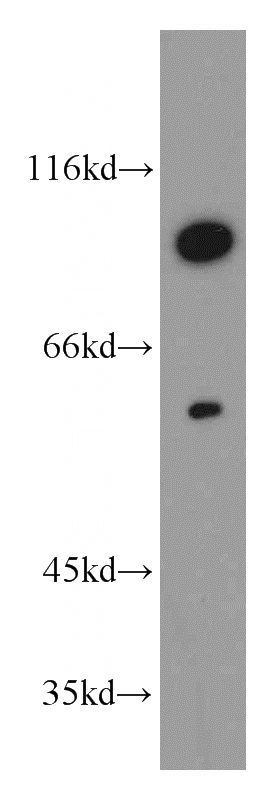 Jurkat cells were subjected to SDS PAGE followed by western blot with Catalog No:115354(SLCO6A1 antibody) at dilution of 1:500