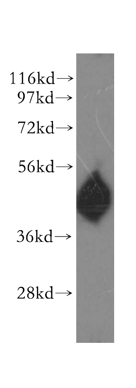 human spleen tissue were subjected to SDS PAGE followed by western blot with Catalog No:111906(SERPINA4 antibody) at dilution of 1:400