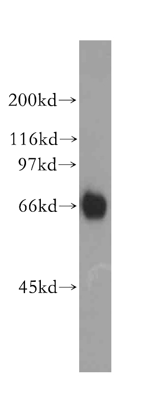 HL-60 cells were subjected to SDS PAGE followed by western blot with Catalog No:114591(RBBP5 antibody) at dilution of 1:400
