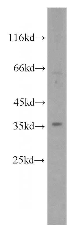 HeLa cells were subjected to SDS PAGE followed by western blot with Catalog No:114654(RHBDL2 antibody) at dilution of 1:500