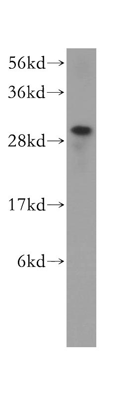 BxPC-3 cells were subjected to SDS PAGE followed by western blot with Catalog No:111727(HUS1 antibody) at dilution of 1:0