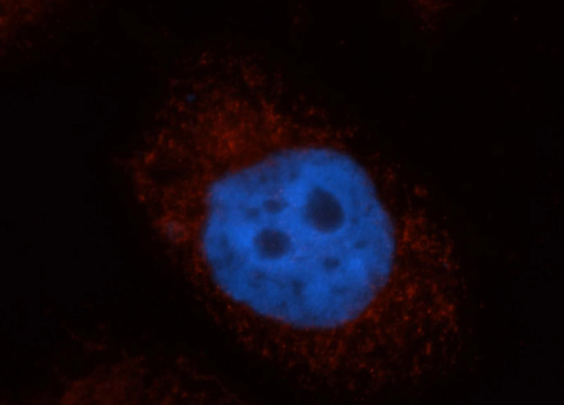 Immunofluorescent analysis of MCF-7 cells, using GNPAT antibody Catalog No:111007 at 1:50 dilution and Rhodamine-labeled goat anti-rabbit IgG (red). Blue pseudocolor = DAPI (fluorescent DNA dye).