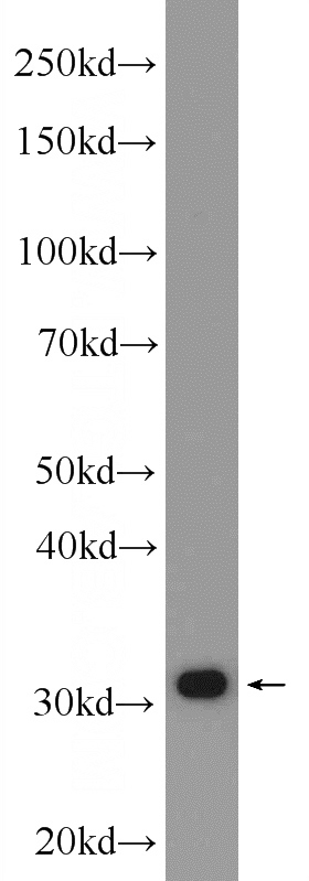 Jurkat cells were subjected to SDS PAGE followed by western blot with Catalog No:108846(CAPZB Antibody) at dilution of 1:1000