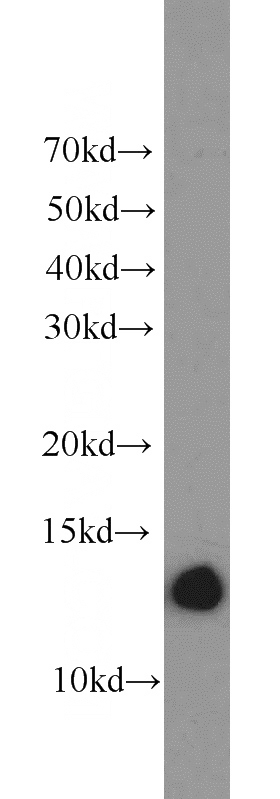 MCF7 cells were subjected to SDS PAGE followed by western blot with Catalog No:108313(ATP6V1F antibody) at dilution of 1:1000