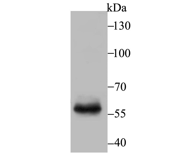Fig1: Western blot analysis of T-bet on mouse marrow tissue lysate using anti-T-bet antibody at 1/500 dilution.