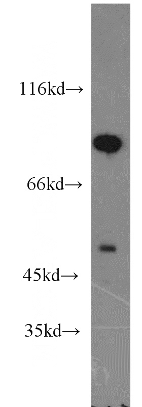 mouse testis tissue were subjected to SDS PAGE followed by western blot with Catalog No:110810(GABRB1 antibody) at dilution of 1:800