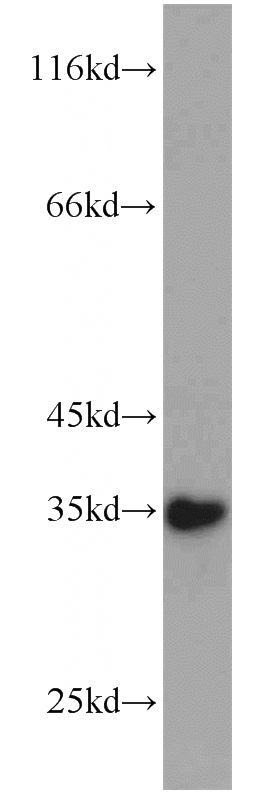 human stomach tissue were subjected to SDS PAGE followed by western blot with Catalog No:115829(SULT1C2 antibody) at dilution of 1:1000