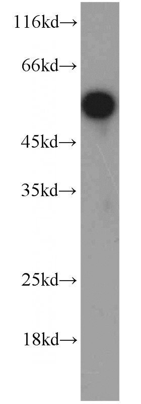 HEK-293 cells were subjected to SDS PAGE followed by western blot with Catalog No:115756(SYAP1 antibody) at dilution of 1:1000