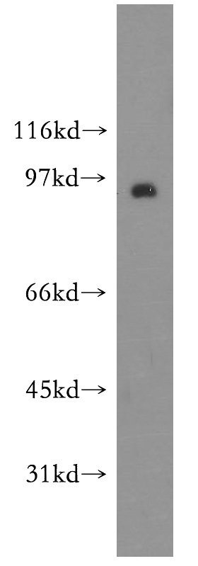 mouse skeletal muscle tissue were subjected to SDS PAGE followed by western blot with Catalog No:115772(SYT11 antibody) at dilution of 1:300