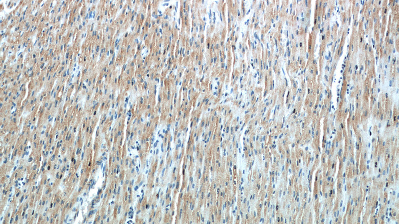 Immunohistochemical of paraffin-embedded human heart using Catalog No:116322(TRIM63 antibody) at dilution of 1:50 (under 10x lens)