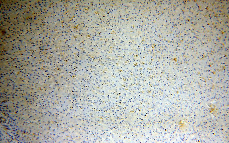 Immunohistochemical of paraffin-embedded human liver using Catalog No:111266(HBB antibody) at dilution of 1:100 (under 10x lens)