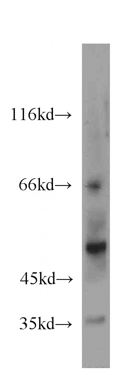 human placenta tissue were subjected to SDS PAGE followed by western blot with Catalog No:113223(NPT1 antibody) at dilution of 1:300