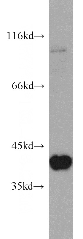 HEK-293 cells were subjected to SDS PAGE followed by western blot with Catalog No:107593(SMN2 antibody) at dilution of 1:1000