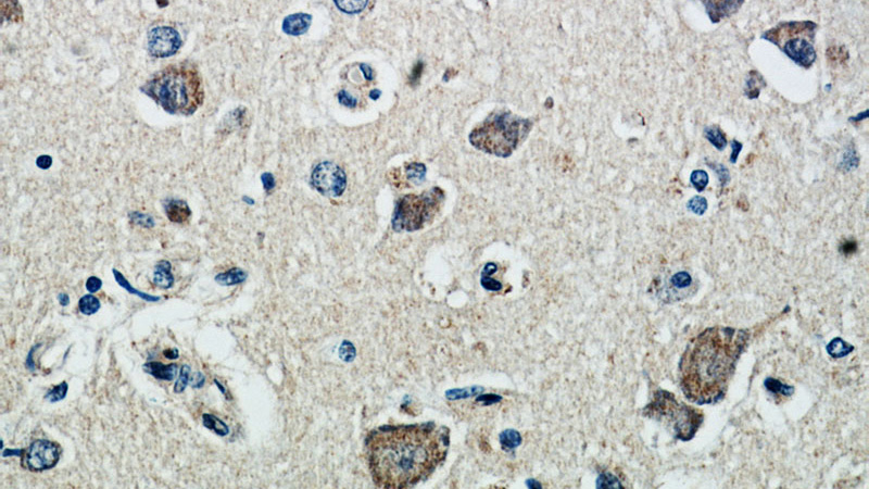 Immunohistochemical of paraffin-embedded human brain using Catalog No:108710(CTA-216E10.6 antibody) at dilution of 1:100 (under 40x lens)