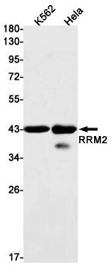 Western blot detection of RRM2 in K562,Hela cell lysates using RRM2 Rabbit mAb(1:1000 diluted).Predicted band size:45kDa.Observed band size:45kDa.