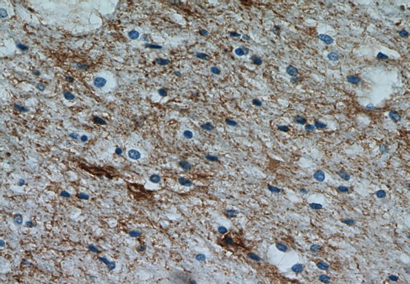 Immunohistochemical of paraffin-embedded human brain using Catalog No:114263(PTCH2 antibody) at dilution of 1:50 (under 40x lens)