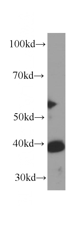 HepG2 cells were subjected to SDS PAGE followed by western blot with Catalog No:107610(STOML2 antibody) at dilution of 1:1000