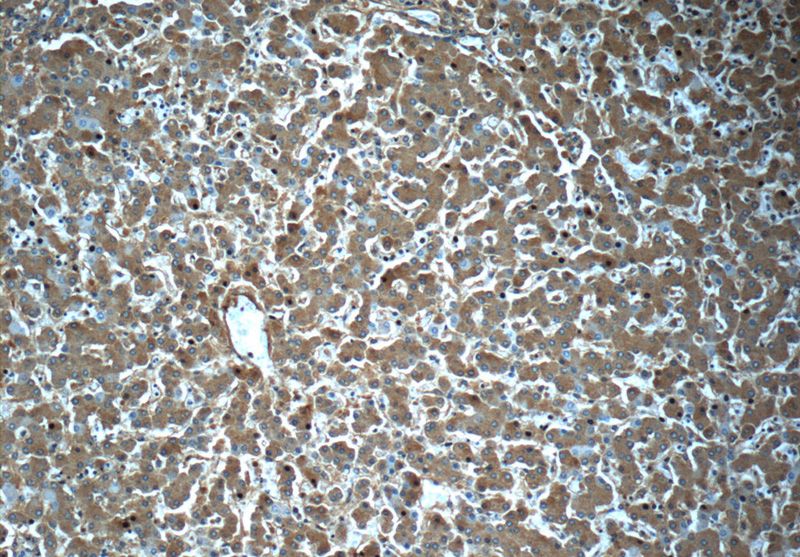 Immunohistochemistry of paraffin-embedded human liver slide using Catalog No:107581(A2M Antibody) at dilution of 1:50