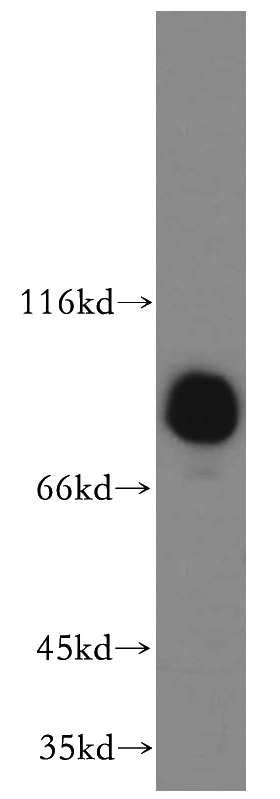 HeLa cells were subjected to SDS PAGE followed by western blot with Catalog No:110395(EPS8L2 antibody) at dilution of 1:1500