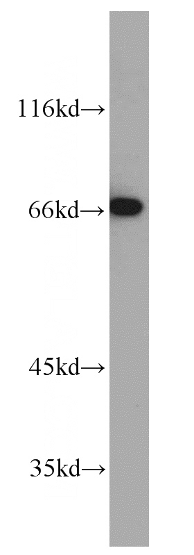 SH-SY5Y cells were subjected to SDS PAGE followed by western blot with Catalog No:112632(MEF2C antibody) at dilution of 1:500