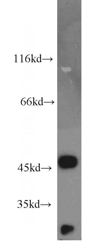 mouse kidney tissue were subjected to SDS PAGE followed by western blot with Catalog No:116055(THBS3-Specific antibody) at dilution of 1:1000