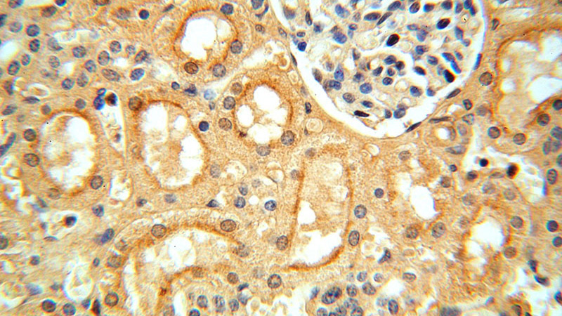 Immunohistochemical of paraffin-embedded human kidney using Catalog No:116721(VAV1 antibody) at dilution of 1:50 (under 40x lens)