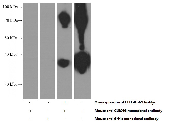 Transfected HEK-293 cells were subjected to SDS PAGE followed by western blot with Catalog No:107161(CLEC4G Antibody) at dilution of 1:1000