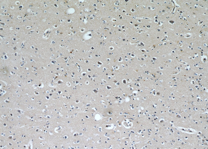 Immunohistochemical of paraffin-embedded human brain using Catalog No:116851(WBSCR17 antibody) at dilution of 1:100 (under 10x lens)