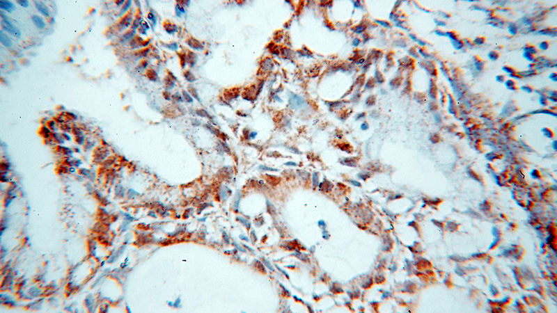Immunohistochemical of paraffin-embedded human cervix using Catalog No:110903(GCHFR antibody) at dilution of 1:100 (under 40x lens)