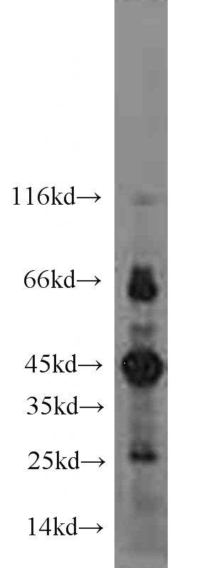 mouse thymus tissue were subjected to SDS PAGE followed by western blot with Catalog No:110686(FLCN antibody) at dilution of 1:300