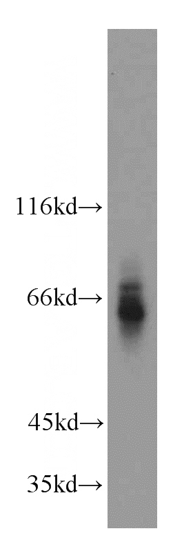 mouse kidney tissue were subjected to SDS PAGE followed by western blot with Catalog No:108302(ATP6AP1 antibody) at dilution of 1:300