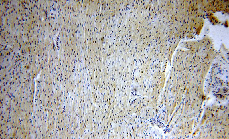 Immunohistochemical of paraffin-embedded human heart using Catalog No:116950(ZNF146 antibody) at dilution of 1:100 (under 10x lens)