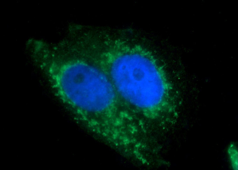Immunofluorescent analysis of HepG2 cells using Catalog No:108400(BAAT Antibody) at dilution of 1:25 and Alexa Fluor 488-congugated AffiniPure Goat Anti-Rabbit IgG(H+L)