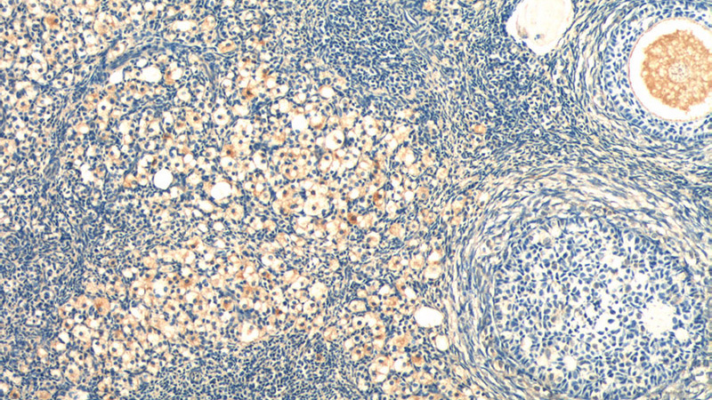 Immunohistochemistry of paraffin-embedded human ovary tissue slide using Catalog No:115676(STAR Antibody) at dilution of 1:50 (under 10x lens)