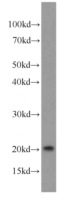 SGC-7901 cells were subjected to SDS PAGE followed by western blot with Catalog No:114543(RANGRF antibody) at dilution of 1:1000