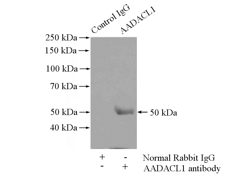 IP Result of anti-AADACL1 (IP:Catalog No:107670, 4ug; Detection:Catalog No:107670 1:500) with COLO 320 cells lysate 400ug.