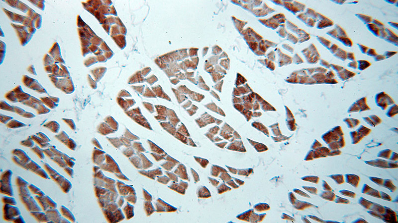 Immunohistochemical of paraffin-embedded human skeletal muscle using Catalog No:112687(MLXIP antibody) at dilution of 1:100 (under 10x lens)