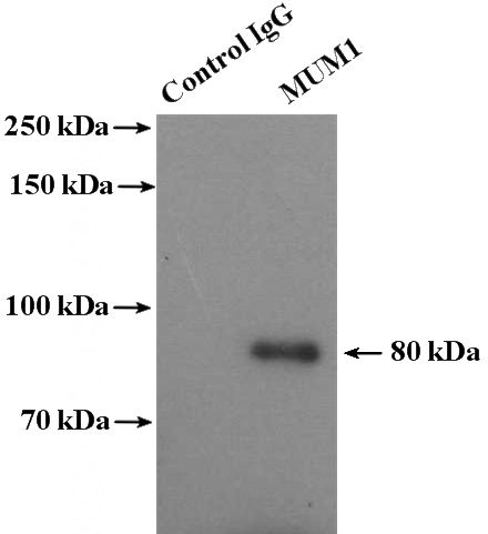 IP Result of anti-MUM1 (IP:Catalog No:112896, 4ug; Detection:Catalog No:112896 1:300) with Jurkat cells lysate 4000ug.