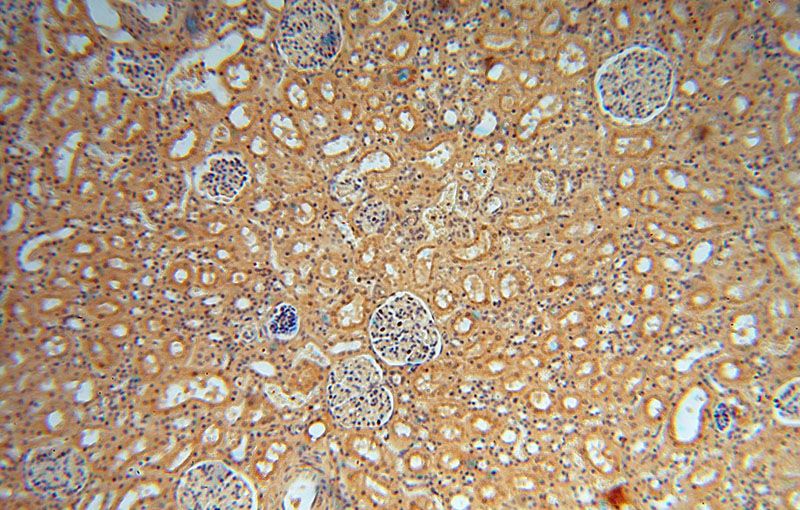 Immunohistochemical of paraffin-embedded human kidney using Catalog No:116721(VAV1 antibody) at dilution of 1:50 (under 10x lens)