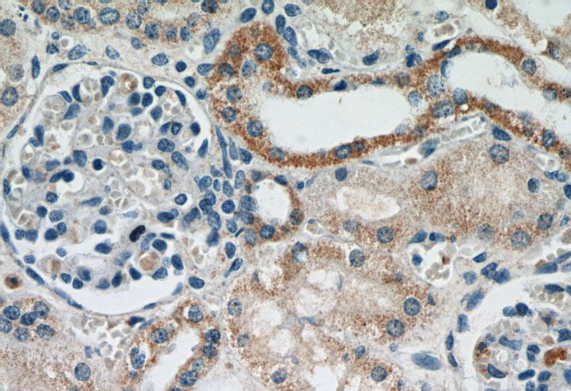Immunohistochemical of paraffin-embedded human kidney using Catalog No:109687(CYP24A1 antibody) at dilution of 1:50 (under 40x lens)
